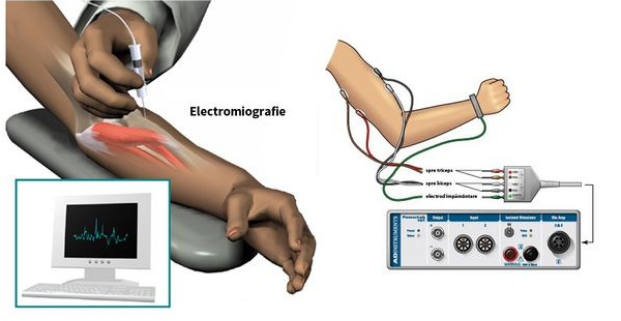 طرق تشخيص أسباب تنميل الرجل